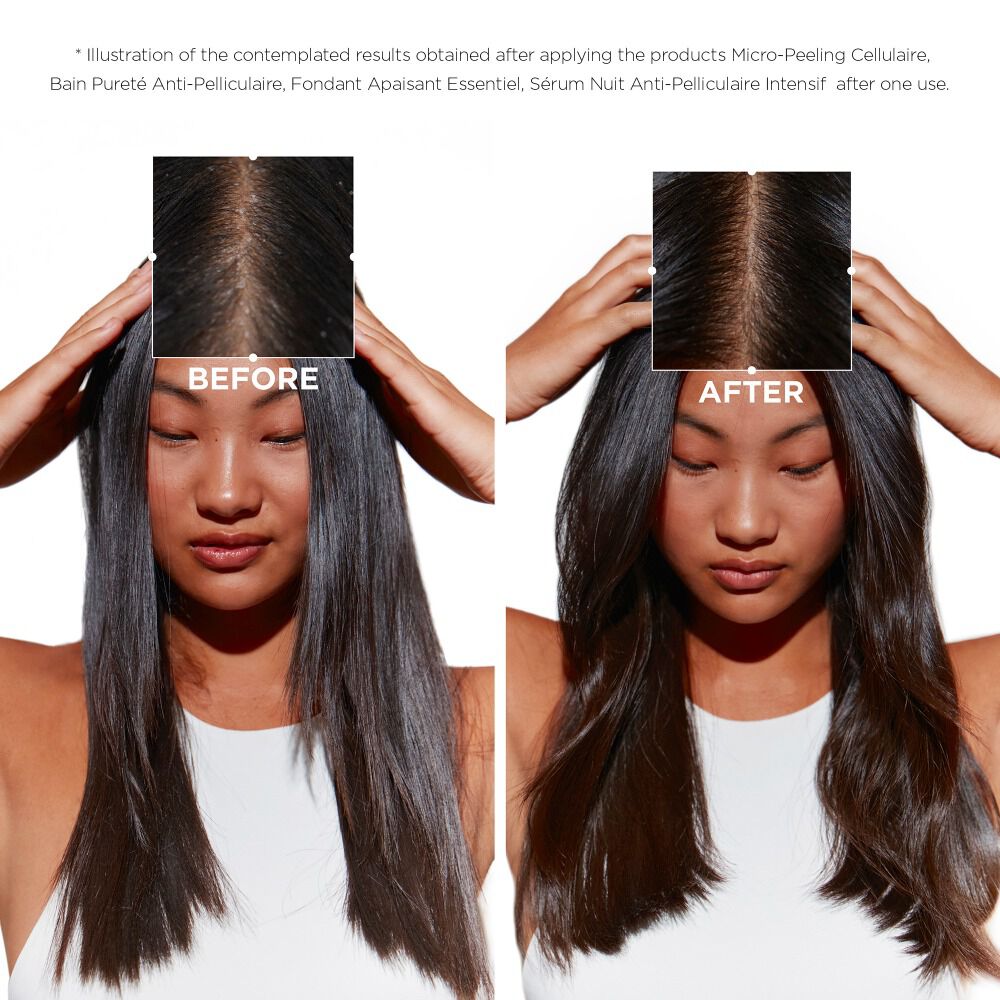 سيمبيوز سيروم ليلي مركّز مضاد للقشرة